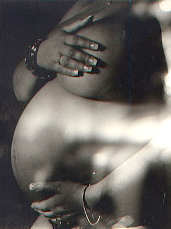I Had a Miscarriage 